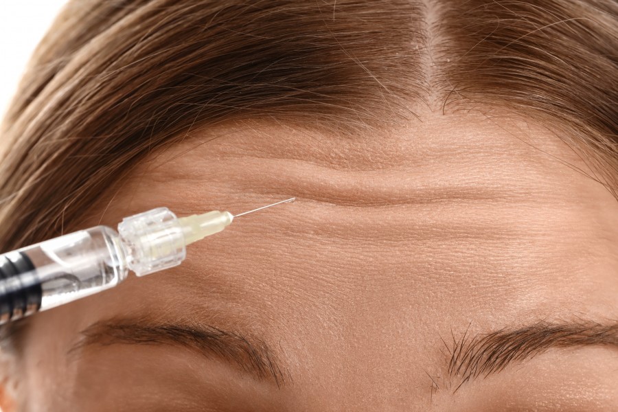 Que faire en cas de botox front raté ?