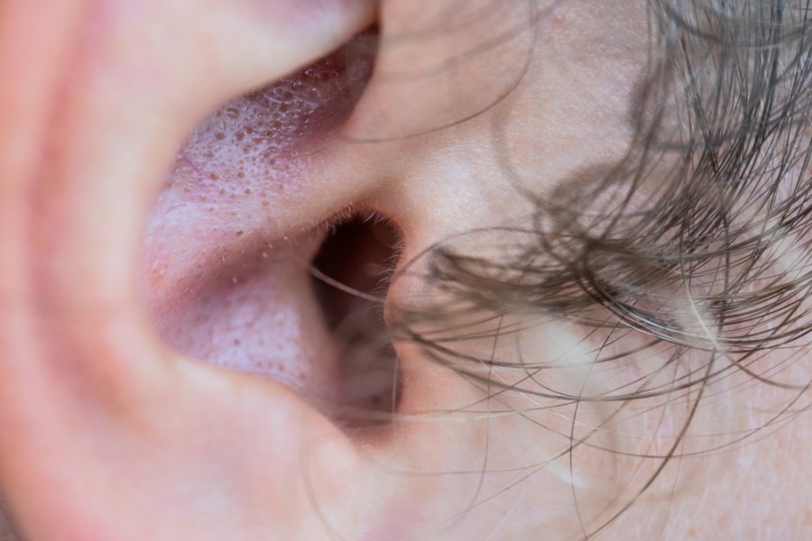 Comment traiter le point noir dans l'oreille ?